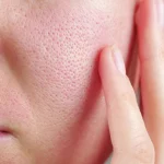 A woman's close up of her face with pores